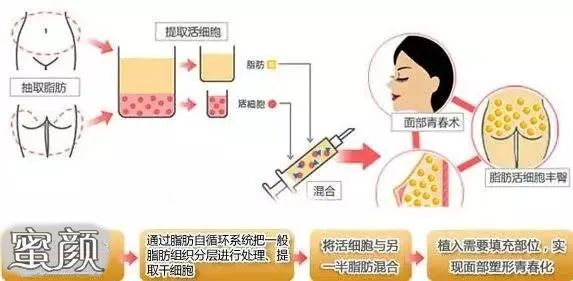 案例图片