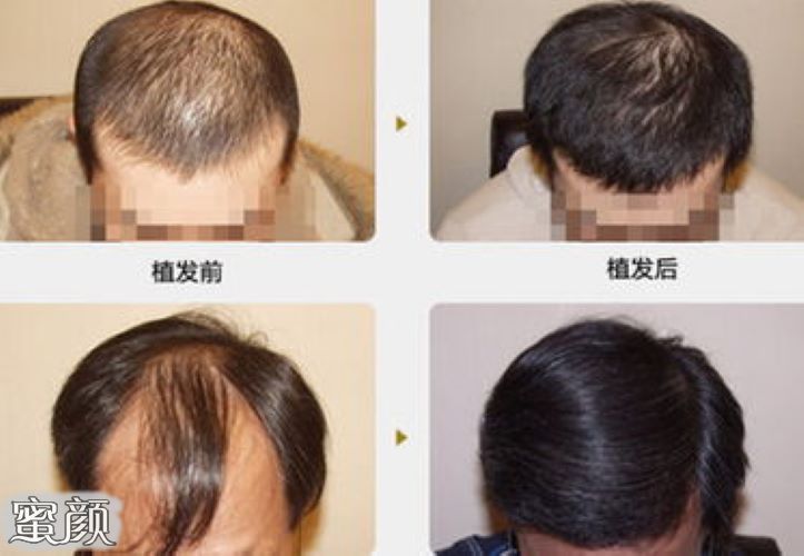 案例图片