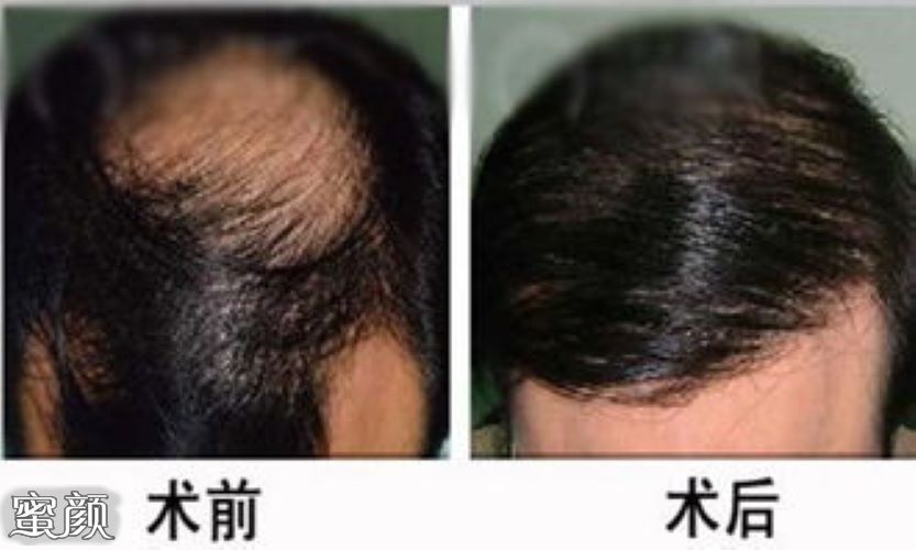 案例图片