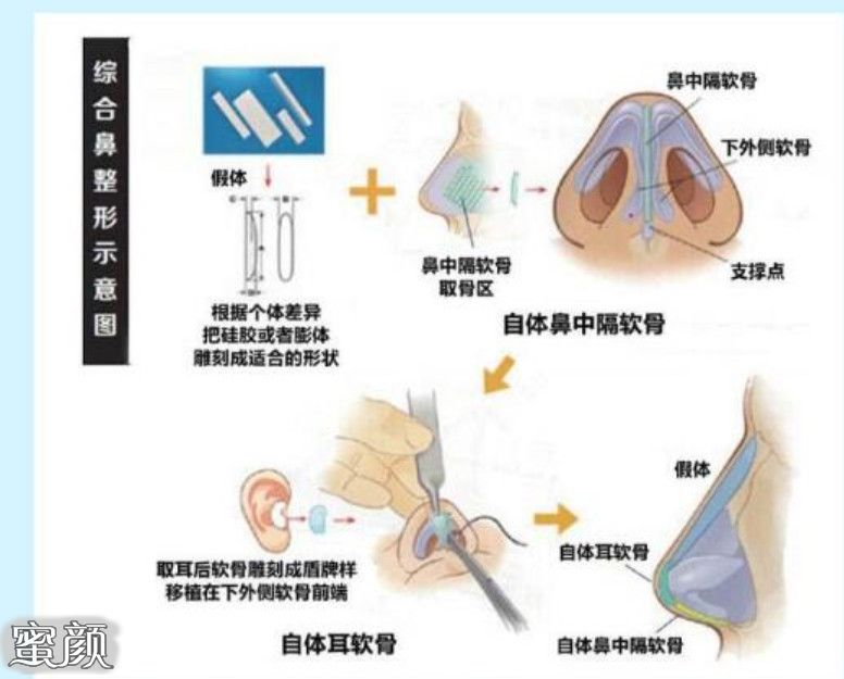 案例图片