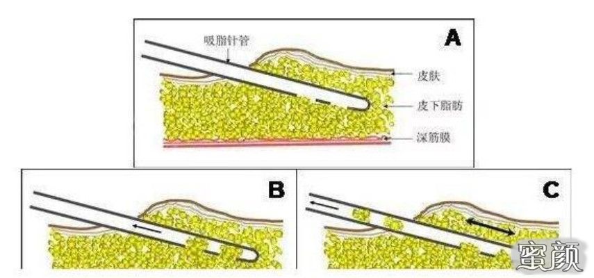 https://img.yiyiaimei.com/mnt/Editor/2020-10-25/5f954c6a5c6c2.jpg