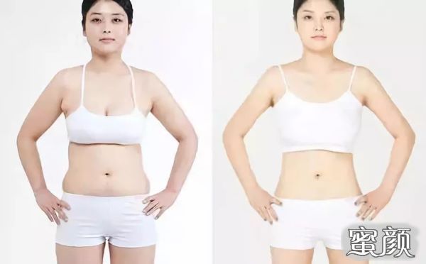 https://img.yiyiaimei.com/mnt/Editor/2020-10-25/5f954c7e3a053.jpg
