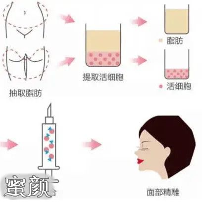 案例图片