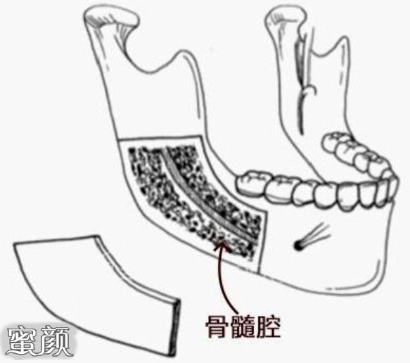 案例图片