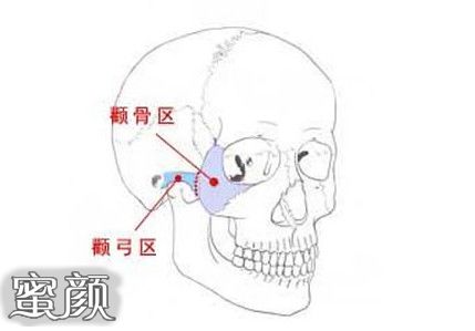 案例图片