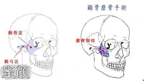 案例图片