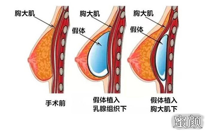 案例图片