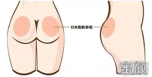 案例图片