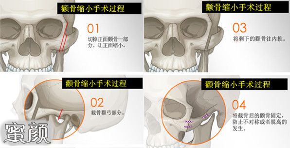 案例图片