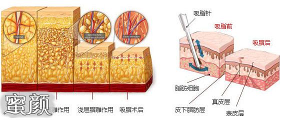 https://img.yiyiaimei.com/mnt/Editor/2020-10-30/5f9c0621854e4.jpg