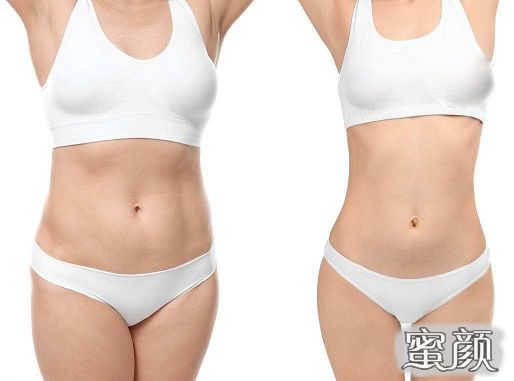 https://img.yiyiaimei.com/mnt/Editor/2020-10-30/5f9c062ea8ca1.jpg