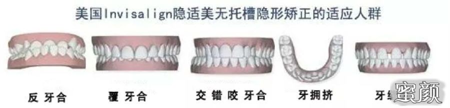 https://img.yiyiaimei.com/mnt/Editor/2020-11-01/5f9e4980ed15e.jpg
