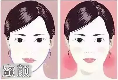 案例图片