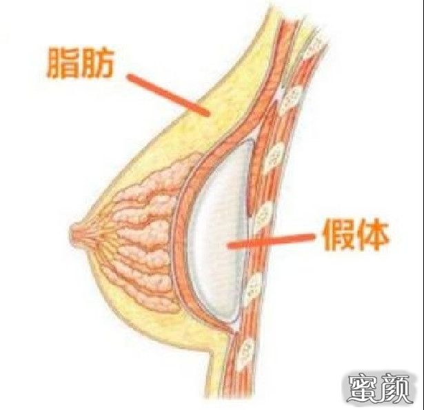 案例图片