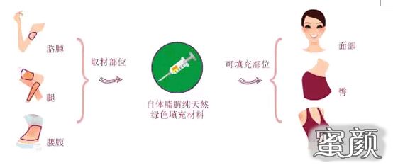 https://img.yiyiaimei.com/mnt/Editor/2020-11-04/5fa266488c0fc.jpg
