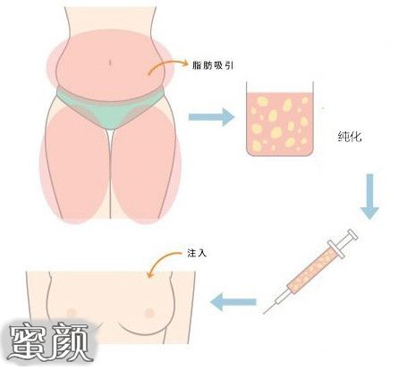 https://img.yiyiaimei.com/mnt/Editor/2020-11-04/5fa266776ea51.jpg