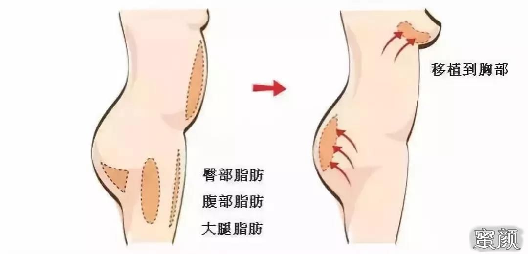 https://img.yiyiaimei.com/mnt/Editor/2020-11-04/5fa2669ea43e3.jpg
