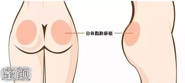 https://img.yiyiaimei.com/mnt/Editor/2020-11-04/5fa267092770e.jpg