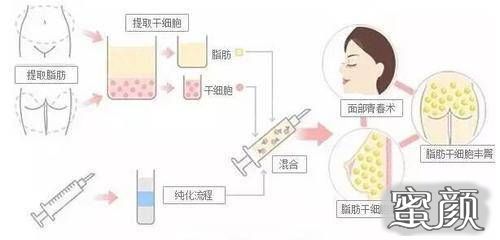 https://img.yiyiaimei.com/mnt/Editor/2020-11-04/5fa2672c31fc8.jpg