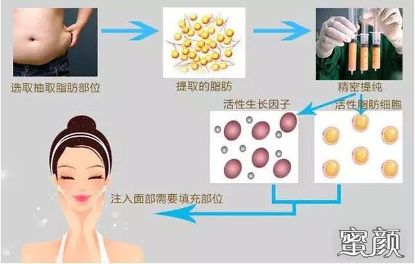 https://img.yiyiaimei.com/mnt/Editor/2020-11-04/5fa26748d303f.jpg