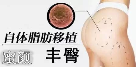 https://img.yiyiaimei.com/mnt/Editor/2020-11-04/5fa2678d3ed7a.jpg