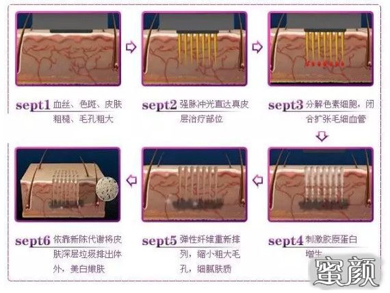 案例图片