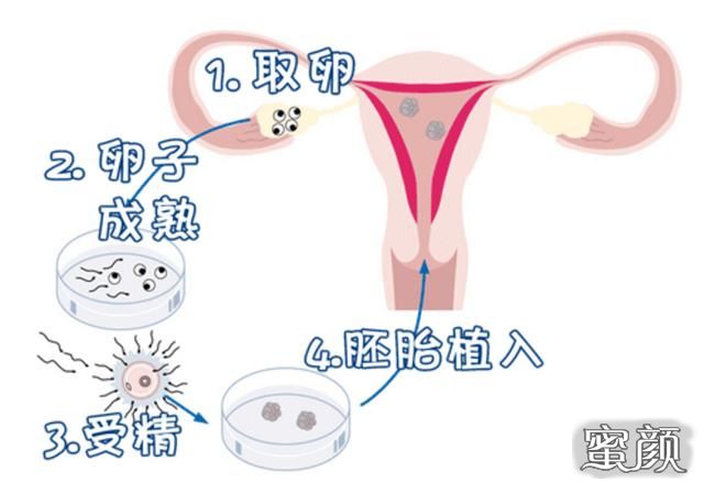 https://img.yiyiaimei.com/mnt/Editor/2020-11-06/5fa511acda2ff.jpg