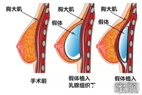 案例图片