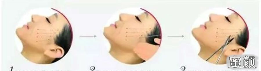 案例图片
