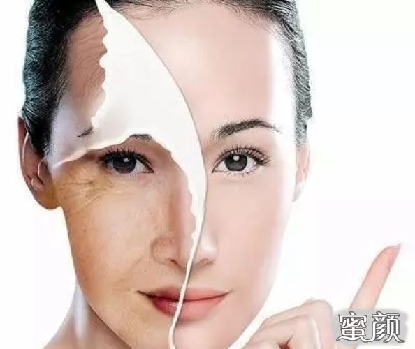 案例图片