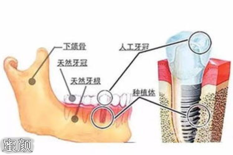 案例图片