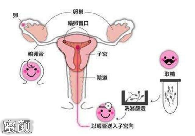 案例图片