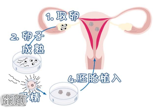 案例图片