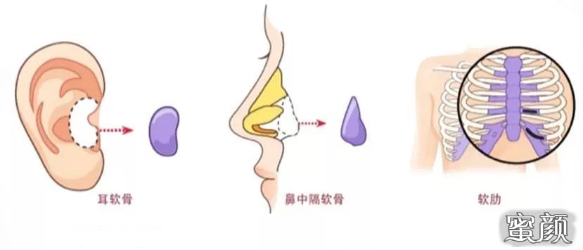 案例图片