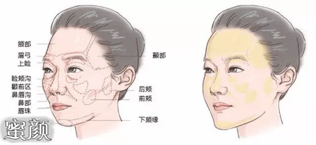 案例图片