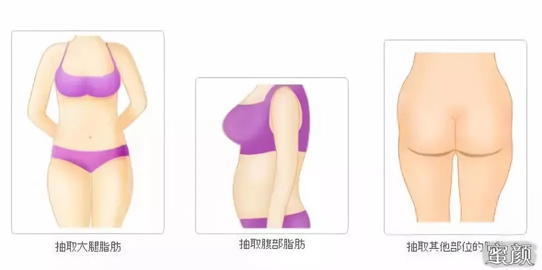 案例图片