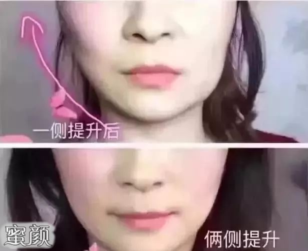 案例图片