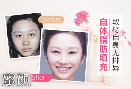 https://img.yiyiaimei.com/mnt/Editor/2020-11-13/5fae980f756d4.jpg