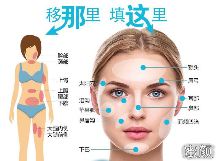 https://img.yiyiaimei.com/mnt/Editor/2020-11-13/5fae98600435e.jpg