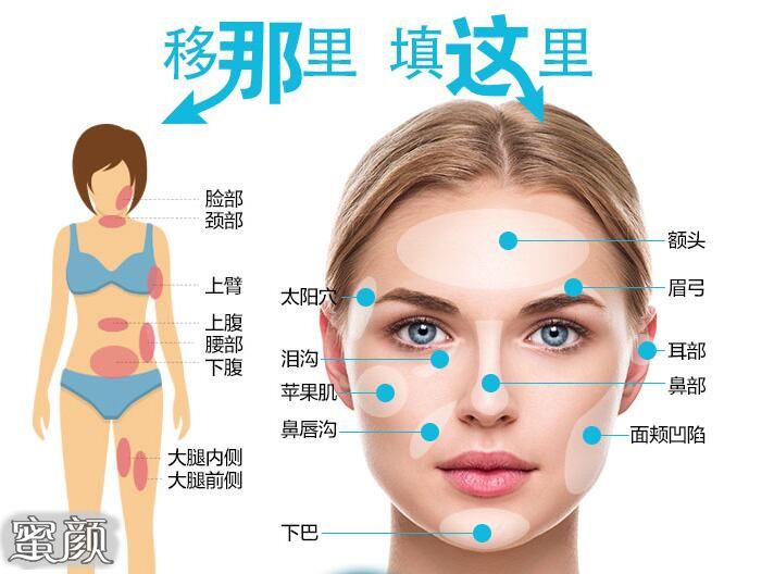 https://img.yiyiaimei.com/mnt/Editor/2020-11-14/5faf605123c80.jpg