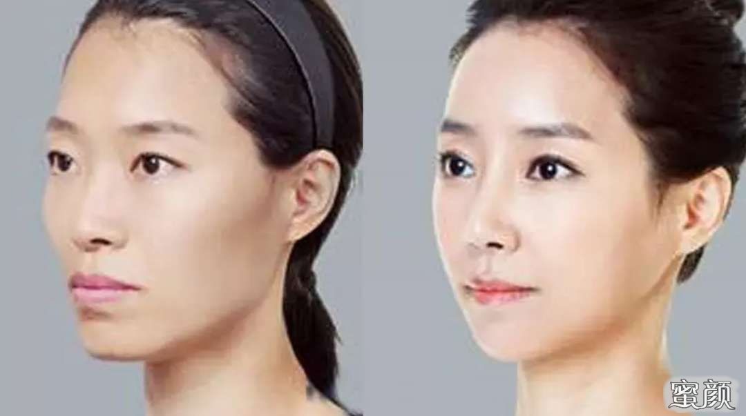 https://img.yiyiaimei.com/mnt/Editor/2020-11-15/5fb0eadcd5228.jpg