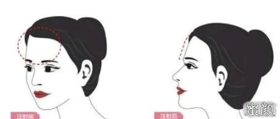 https://img.yiyiaimei.com/mnt/Editor/2020-11-15/5fb0f6621f935.jpg