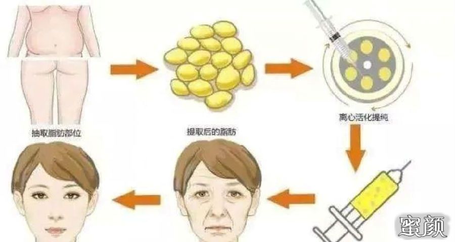 https://img.yiyiaimei.com/mnt/Editor/2020-11-15/5fb0fc2678430.jpg