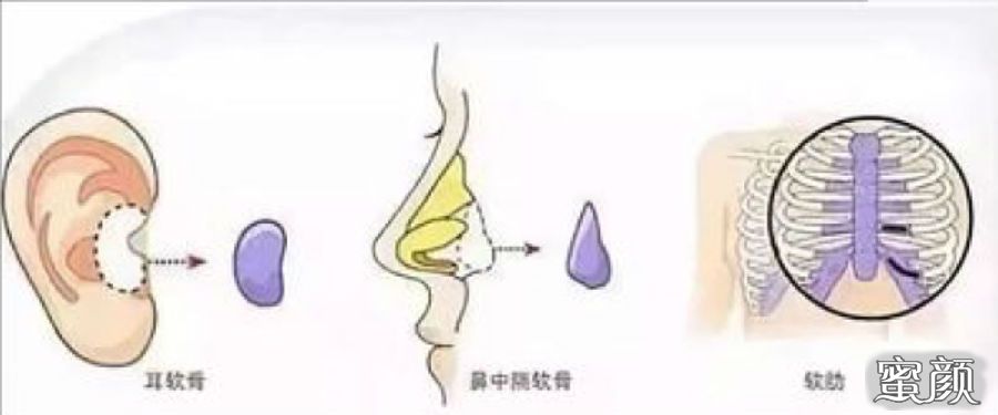 https://img.yiyiaimei.com/mnt/Editor/2020-11-16/5fb26532c9f0b.jpg