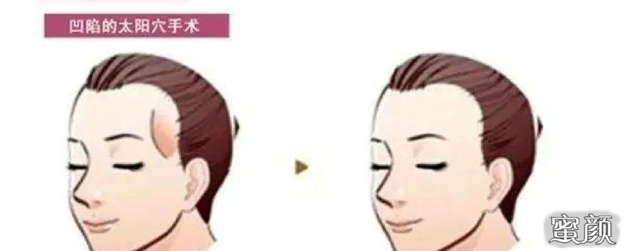 案例图片