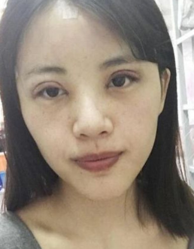 案例图片