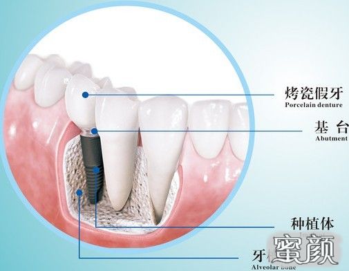 案例图片