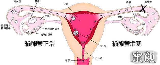 案例图片