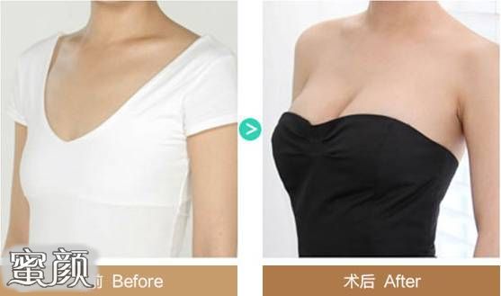https://img.yiyiaimei.com/mnt/Editor/2020-11-18/5fb4fa055d0aa.jpg