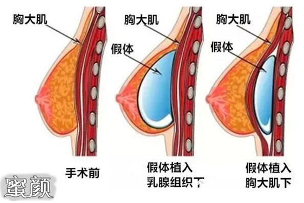 案例图片